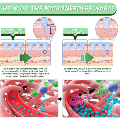 [See results in 7 days]🌲Cvreoz® SMGT-GLP-1 Nano Microneedle Patch（Painless, long-lasting, addressing diabetes, obesity, and cardiovascular diseases）